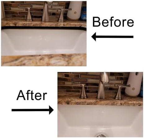 Undermount Sink Brackets, Undermount Sink Clips, Sink Repair Kit, Repair - Image 5